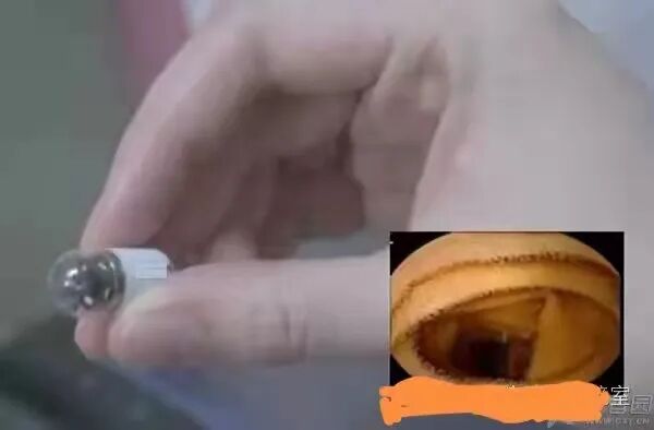 电子胃镜镜是什么【新技术】做胃镜，从此不再“畏镜”！胶囊胃镜来啦_https://www.jmylbn.com_新闻资讯_第2张