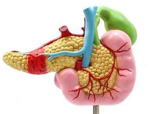 胰腺癌的病因病机与诊断要点