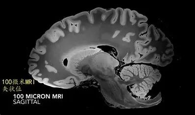 医学仪器有哪些医点点｜医院常见物理仪器知多少_https://www.jmylbn.com_新闻资讯_第28张