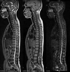 医学仪器有哪些医点点｜医院常见物理仪器知多少_https://www.jmylbn.com_新闻资讯_第26张