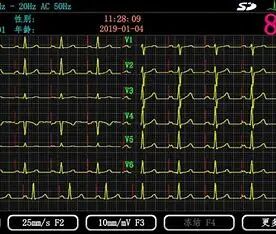 医学仪器有哪些医点点｜医院常见物理仪器知多少_https://www.jmylbn.com_新闻资讯_第39张