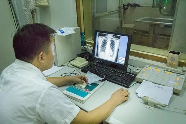 查出胰腺癌，还能活多久？医生：早发现是关键，别错过身体信号