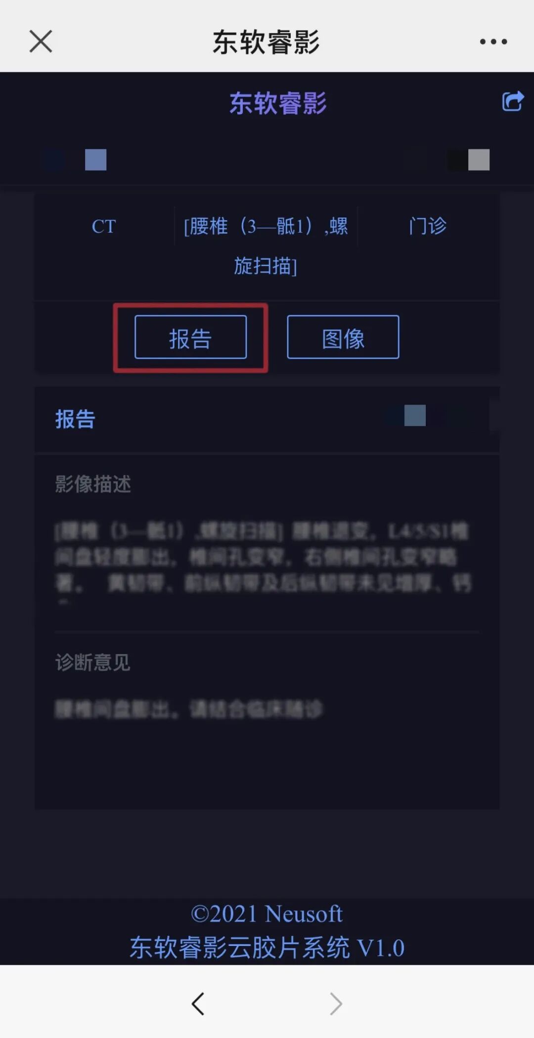 dr胶片怎么看四抓在行动丨“云胶片”服务来啦，CT／DR／MR数字影像和报告手机上就能看！_https://www.jmylbn.com_新闻资讯_第10张