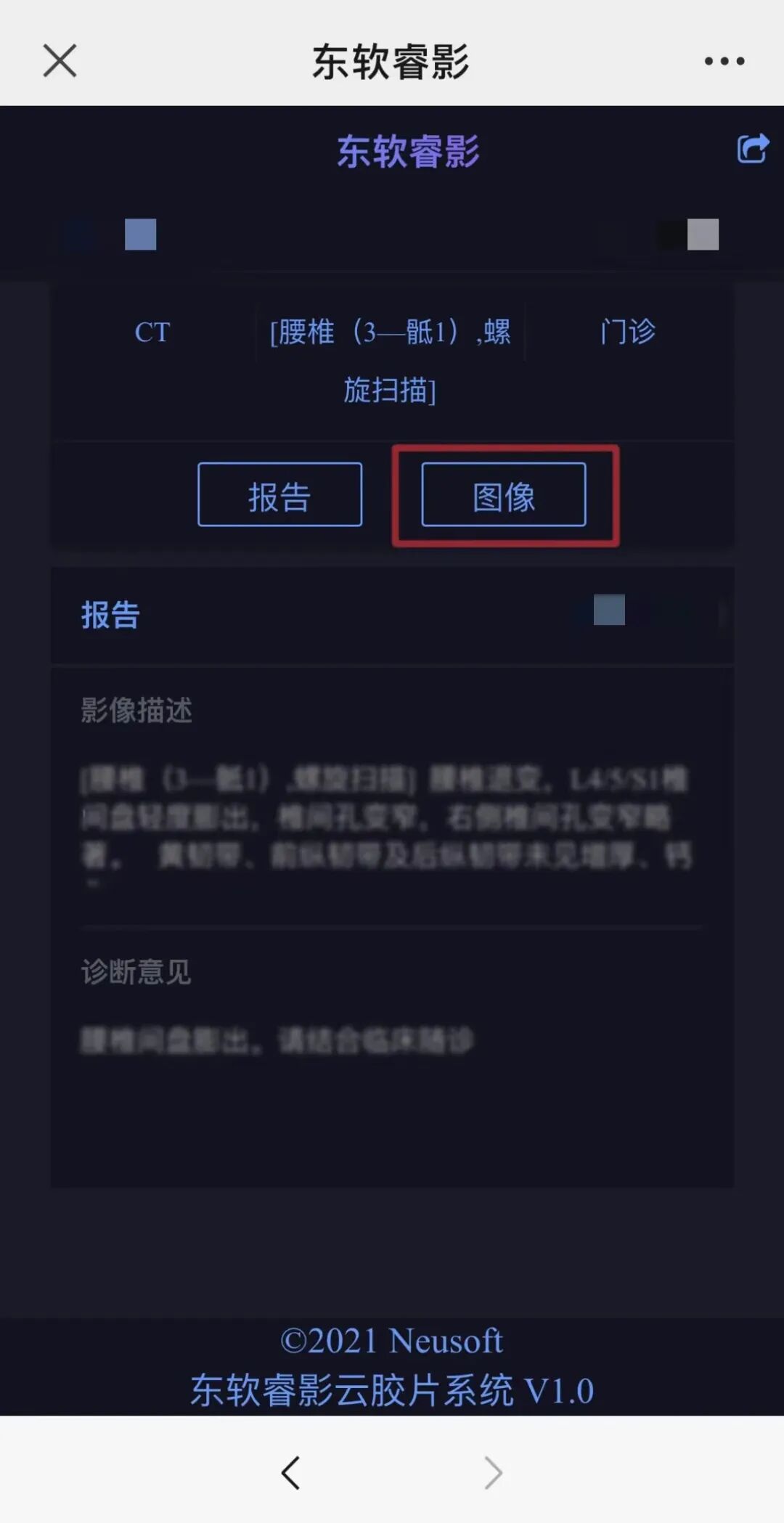 dr胶片怎么看四抓在行动丨“云胶片”服务来啦，CT／DR／MR数字影像和报告手机上就能看！_https://www.jmylbn.com_新闻资讯_第8张