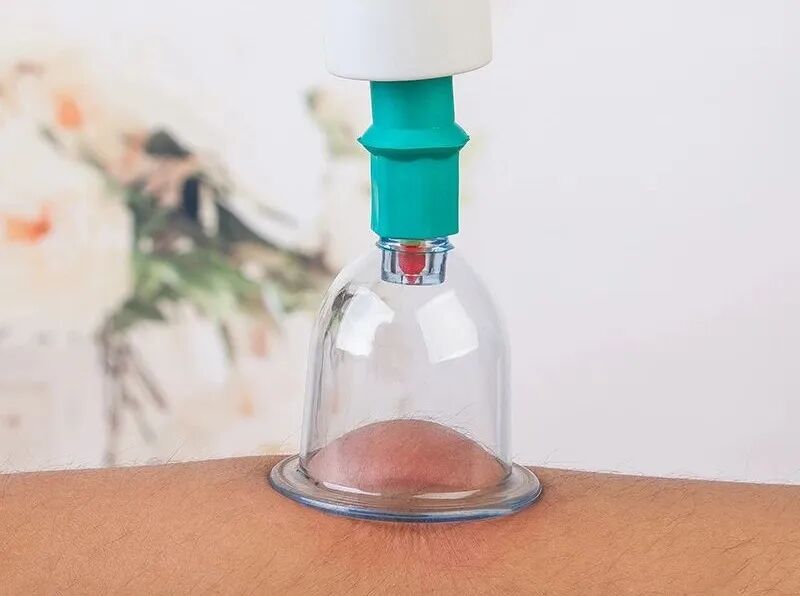 竹火罐怎么用小竹罐，大作用！头部、肩颈、关节都能拔罐！_https://www.jmylbn.com_新闻资讯_第4张