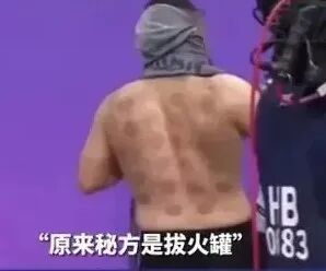 竹火罐怎么用小竹罐，大作用！头部、肩颈、关节都能拔罐！_https://www.jmylbn.com_新闻资讯_第1张