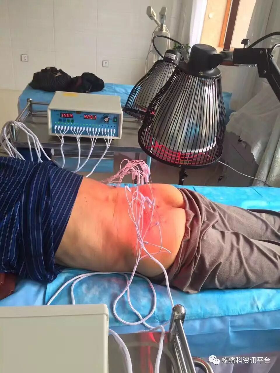 针仪什么意思是什么内热式针灸治疗仪（内热仪）治疗原理_https://www.jmylbn.com_新闻资讯_第4张
