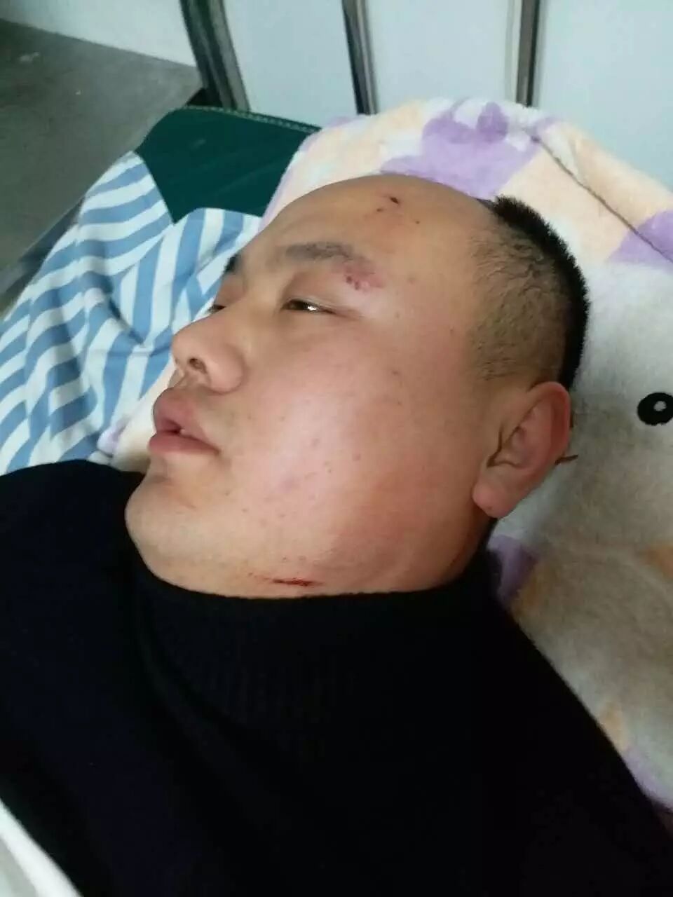 的孩子都在炕上,我说什么事啊,一抬头,一个人踹开门,拿着棍子就开始打
