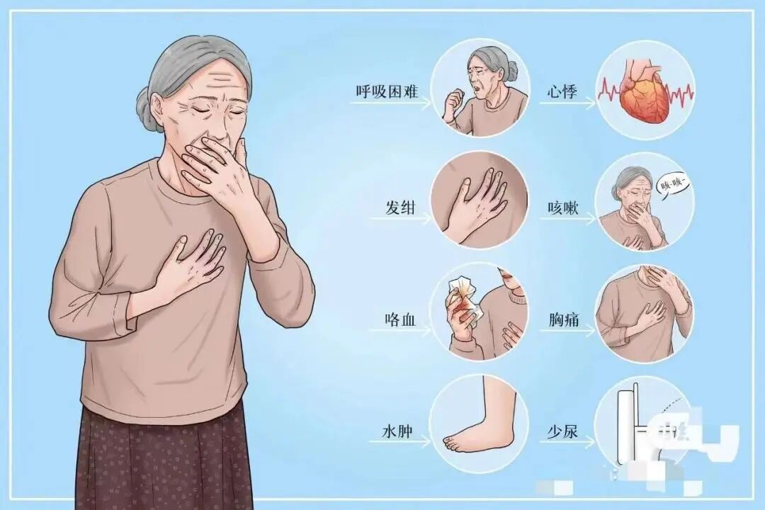 老人吸氧有什么好处吗忆氧 ｜ 吸氧：老年人的灵丹妙药_https://www.jmylbn.com_新闻资讯_第1张