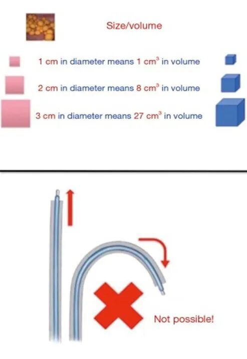 输尿管鞘是什么输尿管软镜碎石术_https://www.jmylbn.com_新闻资讯_第4张