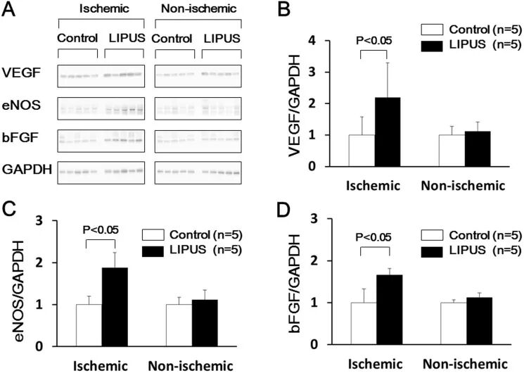 prosound超声怎么调查看部位低强度脉冲超声在慢性心肌缺血猪模型中诱导血管生成并改善左心室功能障碍_https://www.jmylbn.com_新闻资讯_第7张
