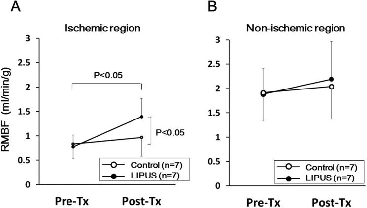prosound超声怎么调查看部位低强度脉冲超声在慢性心肌缺血猪模型中诱导血管生成并改善左心室功能障碍_https://www.jmylbn.com_新闻资讯_第6张