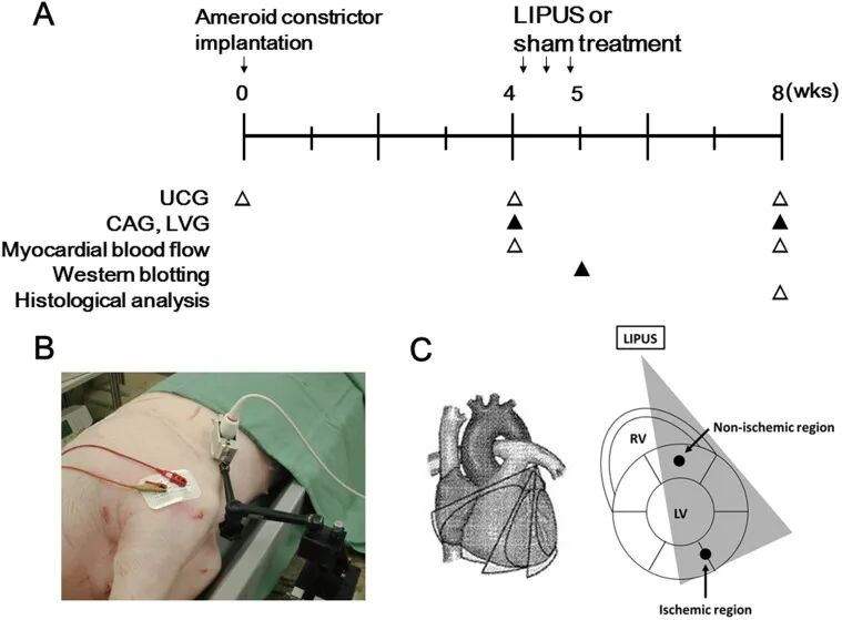 prosound超声怎么调查看部位低强度脉冲超声在慢性心肌缺血猪模型中诱导血管生成并改善左心室功能障碍_https://www.jmylbn.com_新闻资讯_第2张