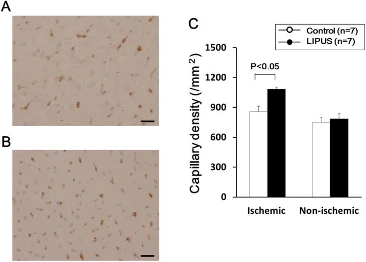 prosound超声怎么调查看部位低强度脉冲超声在慢性心肌缺血猪模型中诱导血管生成并改善左心室功能障碍_https://www.jmylbn.com_新闻资讯_第5张