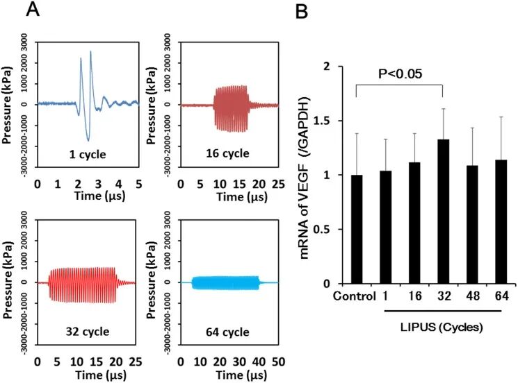 prosound超声怎么调查看部位低强度脉冲超声在慢性心肌缺血猪模型中诱导血管生成并改善左心室功能障碍_https://www.jmylbn.com_新闻资讯_第1张