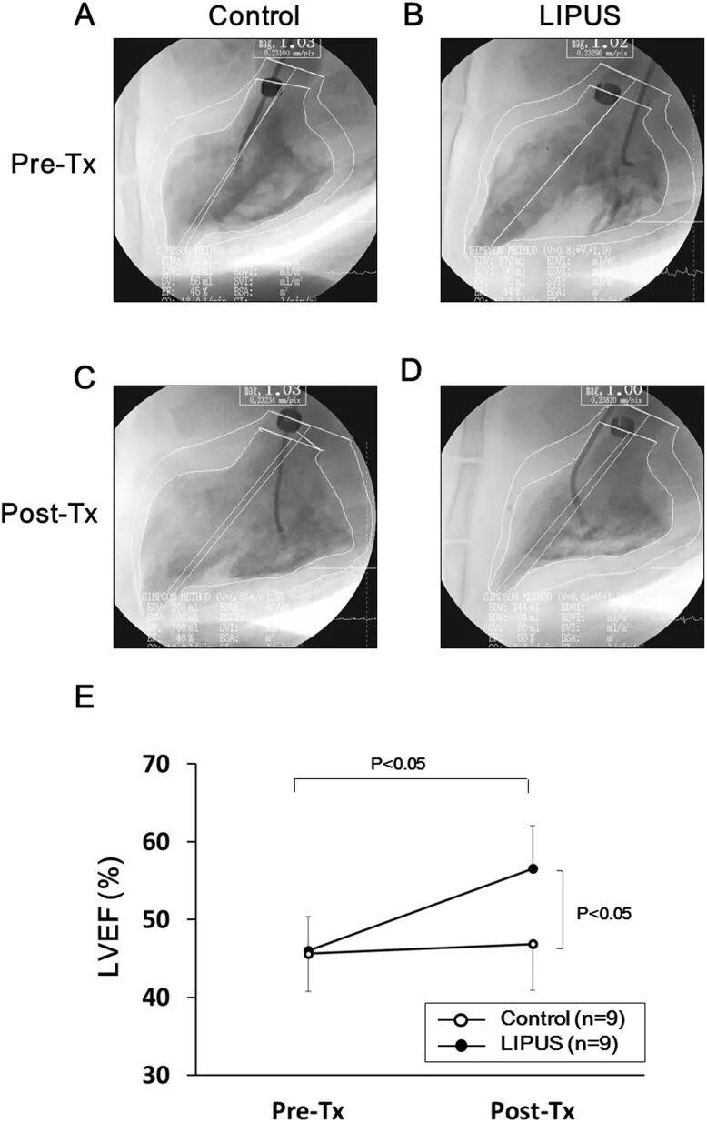 prosound超声怎么调查看部位低强度脉冲超声在慢性心肌缺血猪模型中诱导血管生成并改善左心室功能障碍_https://www.jmylbn.com_新闻资讯_第3张