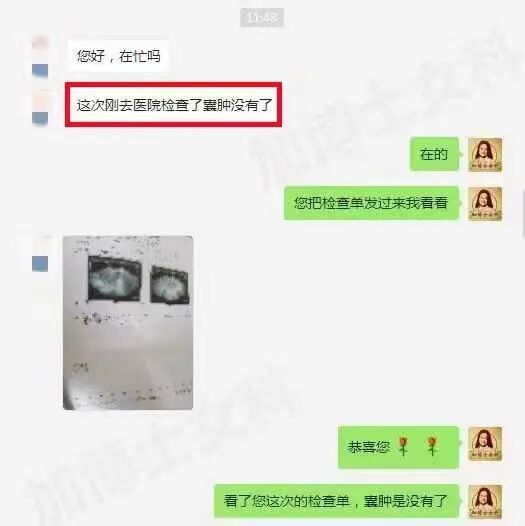 肌瘤钻怎么写术后4年肌瘤再复发，肌瘤竟像爬山虎一样“钻”进了心脏…_https://www.jmylbn.com_新闻资讯_第8张