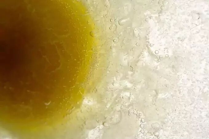 美国第三代试管婴儿技术多维度解析