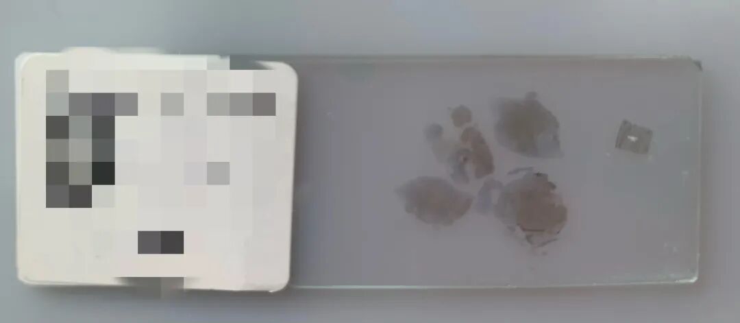 什么是病理蜡块【公卫科普】什么是病理切片、蜡块、白片？_https://www.jmylbn.com_新闻资讯_第28张