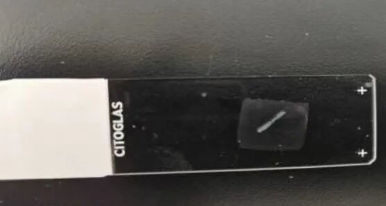 什么是病理蜡块【公卫科普】什么是病理切片、蜡块、白片？_https://www.jmylbn.com_新闻资讯_第19张