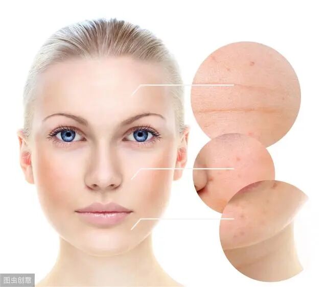 点阵激光后冷敷怎么敷一起来了解一下什么是多模式二氧化碳点阵激光_https://www.jmylbn.com_新闻资讯_第2张