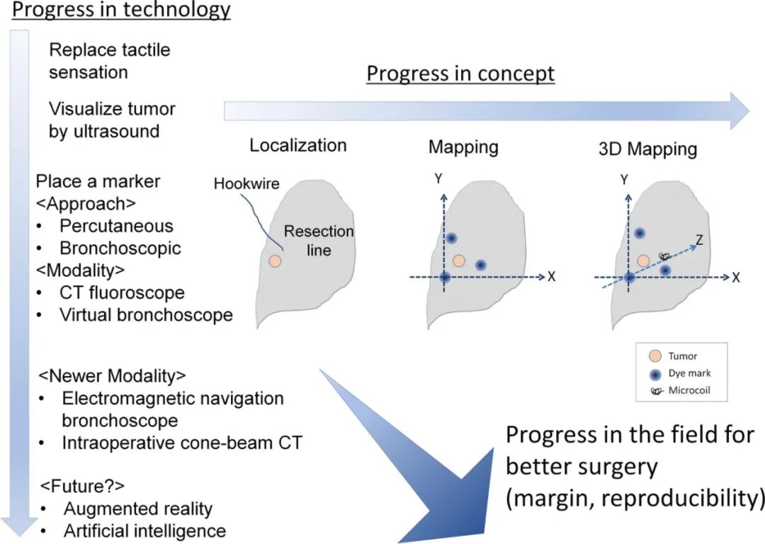 什么是数字肺膨胀肺／萎陷肺的真相：人工气胸下的支气管+肺实质数字模型与三维重建？_https://www.jmylbn.com_新闻资讯_第15张
