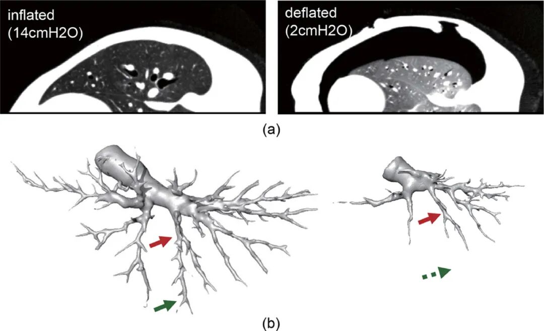 什么是数字肺膨胀肺／萎陷肺的真相：人工气胸下的支气管+肺实质数字模型与三维重建？_https://www.jmylbn.com_新闻资讯_第19张