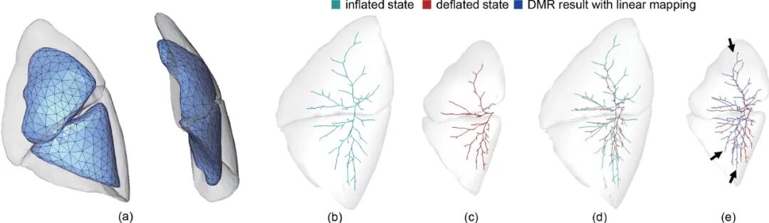 什么是数字肺膨胀肺／萎陷肺的真相：人工气胸下的支气管+肺实质数字模型与三维重建？_https://www.jmylbn.com_新闻资讯_第20张