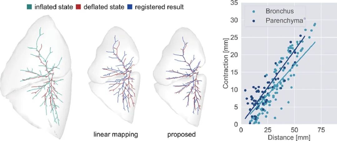 什么是数字肺膨胀肺／萎陷肺的真相：人工气胸下的支气管+肺实质数字模型与三维重建？_https://www.jmylbn.com_新闻资讯_第18张