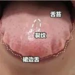 对付湿气的“好帮手”找到了！排湿气、消水气，胜过红豆和薏米~