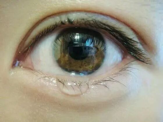 心电监护体温怎么测危重病人病情的晴雨表--心电监护仪_https://www.jmylbn.com_新闻资讯_第10张