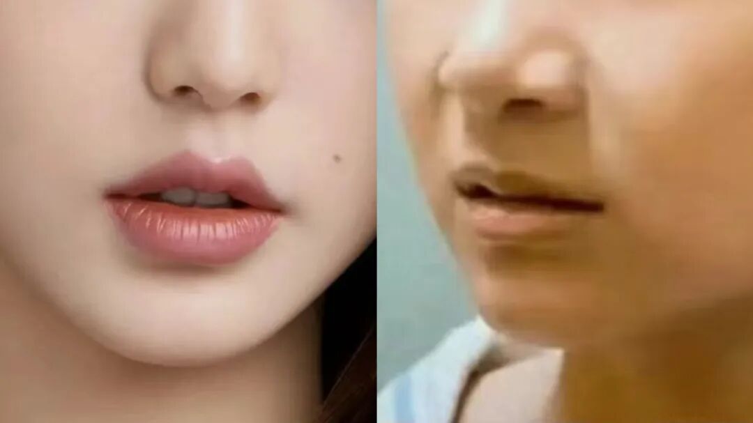 综合立体度,饱满度,形态高度等因素,唇部呼吸