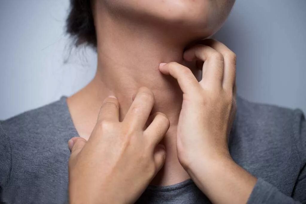 夏季皮炎 埋伏 高发 虫咬性皮炎要怎么预防 黎平同济医院健康城 微信公众号文章阅读 Wemp