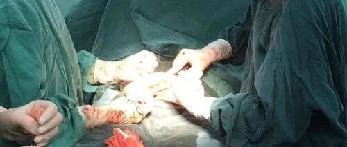 人流和生孩子，哪个更危险?为何说分娩是增分项，人流是减分项?