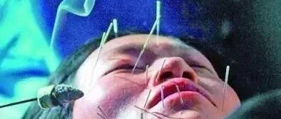 坐月子产妇容易患上的“吊线风”，真的是吹风吹出来的吗？