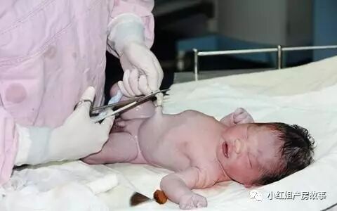 为什么剪脐带要先夹住胎儿出生后多长时间断脐带，30秒，还是2分钟？为什么一定要给婴儿晚断脐？_https://www.jmylbn.com_新闻资讯_第2张