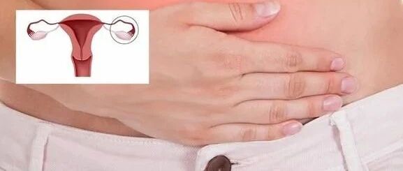 你月经规律吗？为什么有些患者的回答让医生哭笑不得？