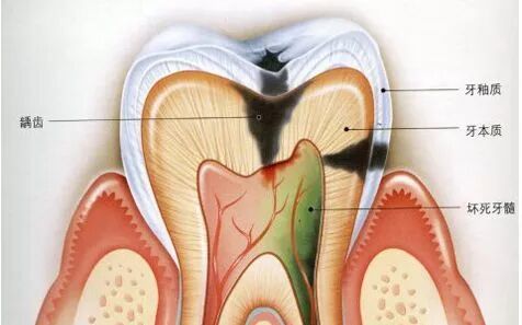 口腔给你的那些“暗示”，我来翻译翻译！