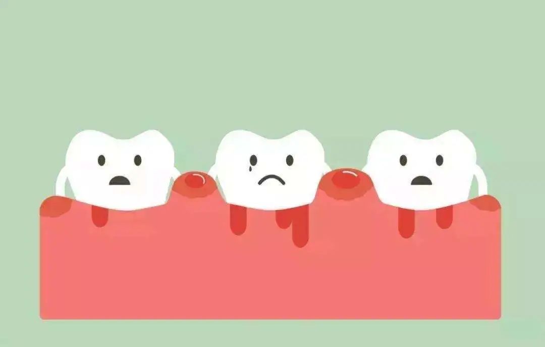 牙齦出血隱藏危險信號！90%的人都忽視了 健康 第1張