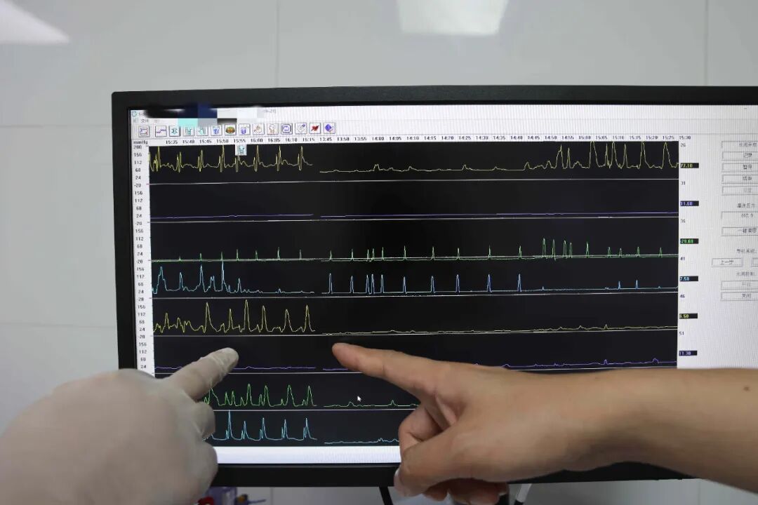 消化道动力检测怎么做【好消息】消化道动力检测及胃动力治疗仪正式上线啦！_https://www.jmylbn.com_新闻资讯_第16张