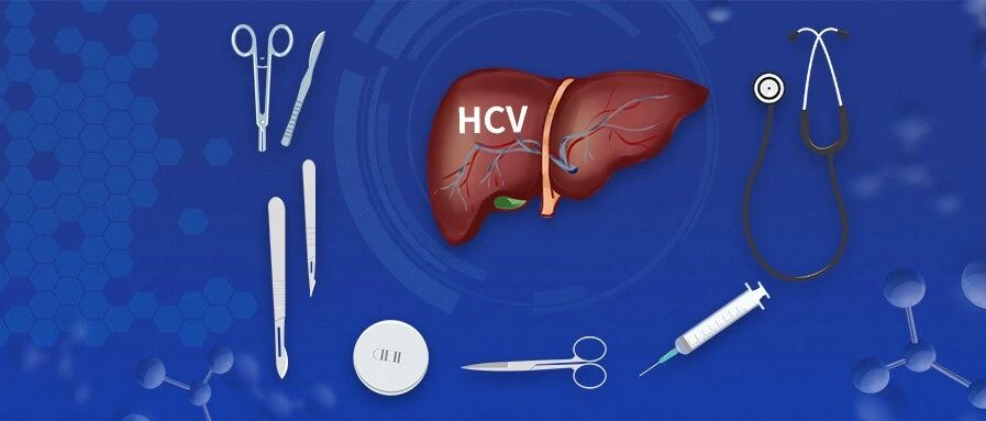 现有医保政策下丙型病毒性肝炎的诊断、治疗与随访 ——临床医生角度看2019丙型肝炎防治指南系列