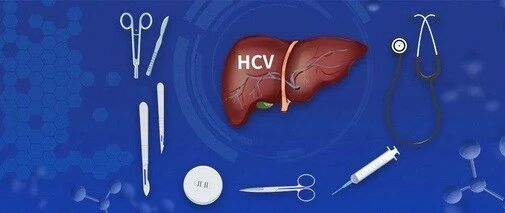 EASL2020 | 真实世界数据为证！沃士韦®治疗DAA经治丙肝患者高度有效