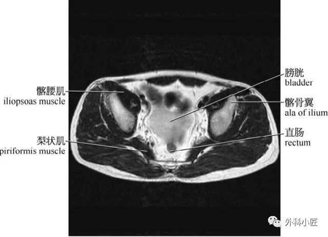 46组对比图带你完全掌握腹部影像解剖_医学界-助力医生临床决策和职业