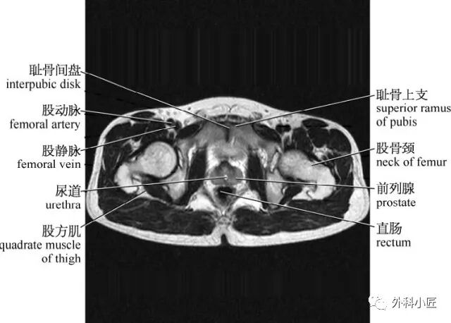 46组对比图带你完全掌握腹部影像解剖_医学界-助力医生临床决策和职业