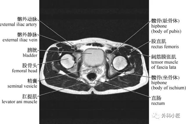 46組對比圖帶你完全掌握腹部影像解剖_醫學界-助力醫生臨床決策和職業