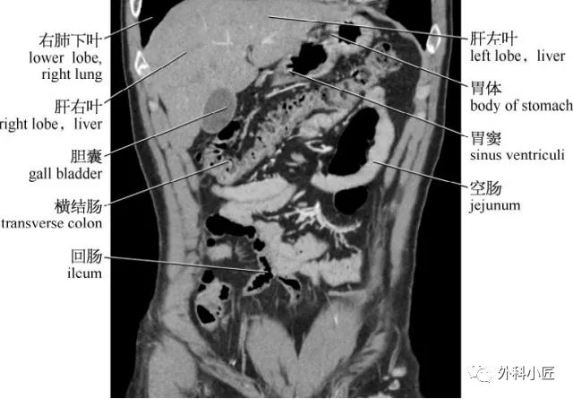 46组对比图带你完全掌握腹部影像解剖_医学界-助力医生临床决策和职业