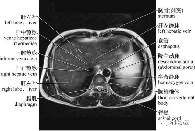 46组对比图带你完全掌握腹部影像解剖_医学界-助力医生临床决策和职业