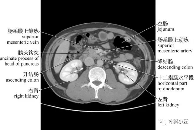 46组对比图带你完全掌握腹部影像解剖_医学界-助力医生临床决策和职业