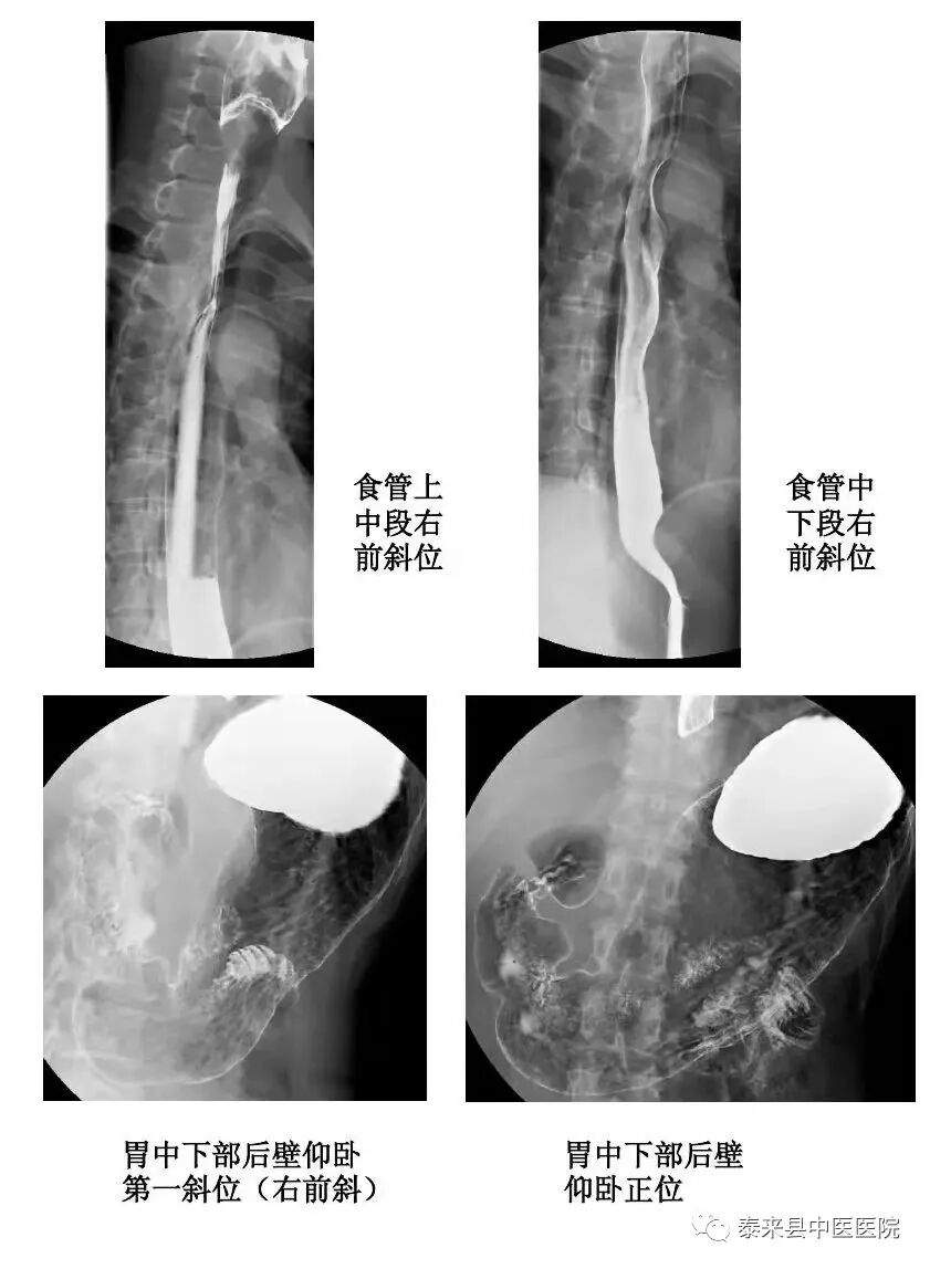 数字胃肠透视怎么做〖医疗篇〗数字化透视、造影、摄影---DRF-4动态大平板数字胃肠机_https://www.jmylbn.com_新闻资讯_第7张
