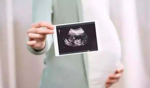 汕头彩超怎么样不再抓瞎！一篇文章带你读懂孕期排畸检查，看完记得收藏 ｜ 汕头妇产科医院_https://www.jmylbn.com_新闻资讯_第2张